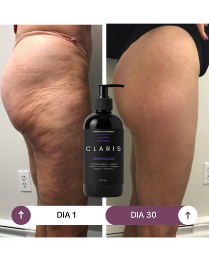 Dermodeluxe Alta Cosmetica: Reduce las Celulitis, Estrias y Flacidez en 30 dias