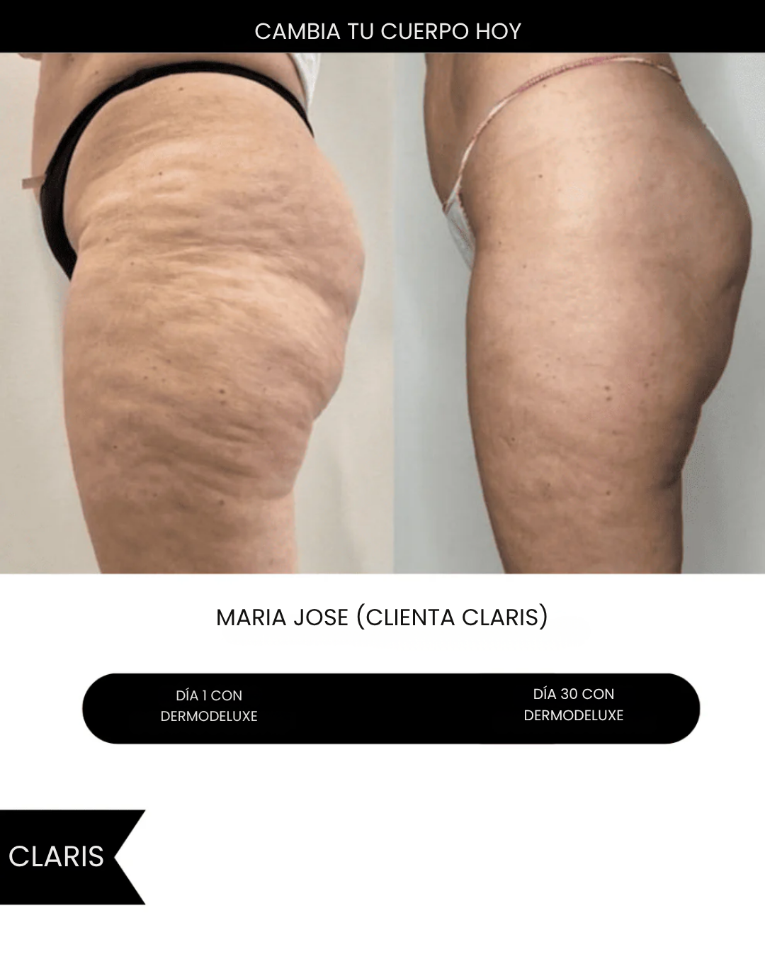 Dermodeluxe Alta Cosmetica: Reduce las Celulitis, Estrias y Flacidez en 30 dias