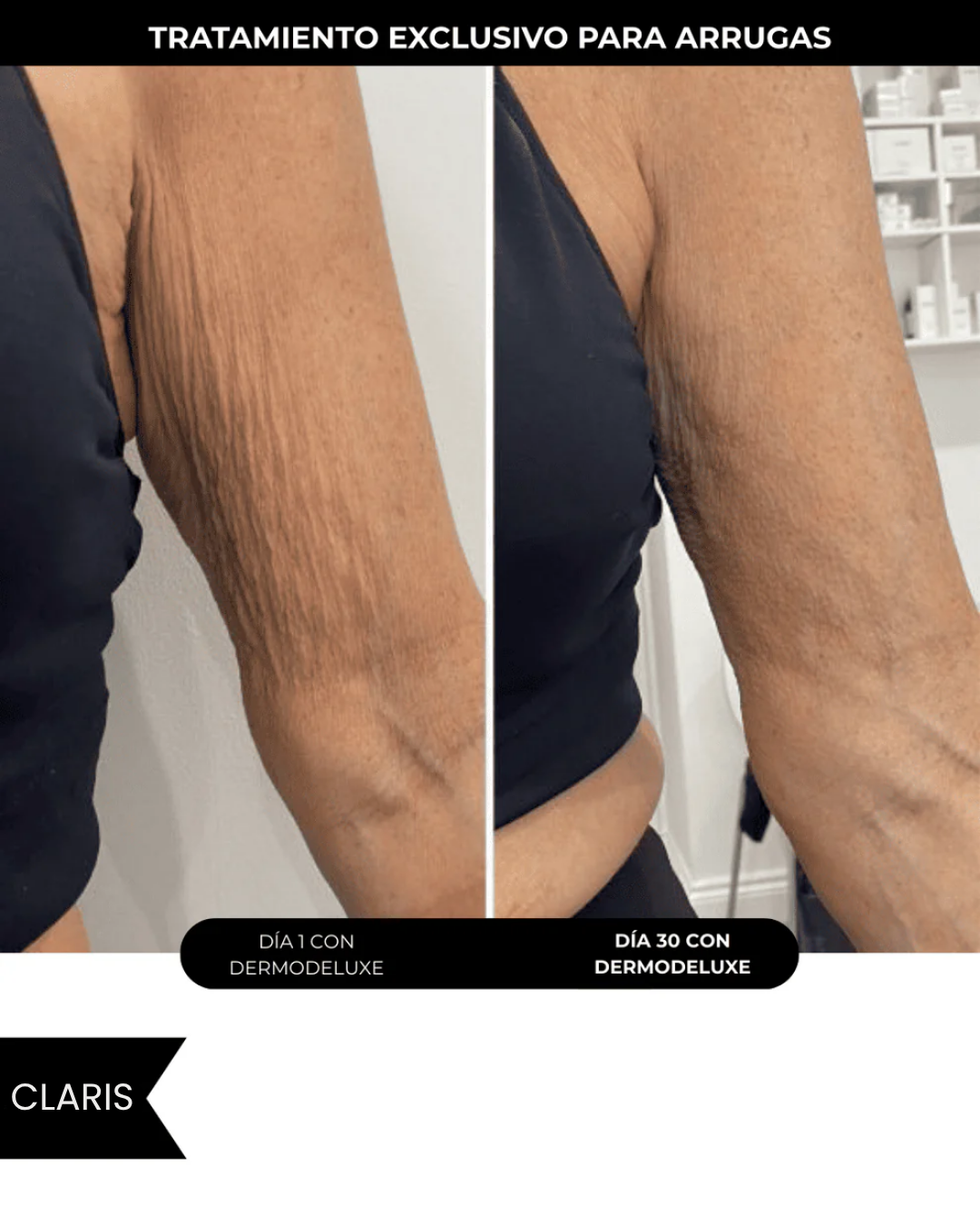 Dermodeluxe Alta Cosmetica: Reduce las Celulitis, Estrias y Flacidez en 30 dias